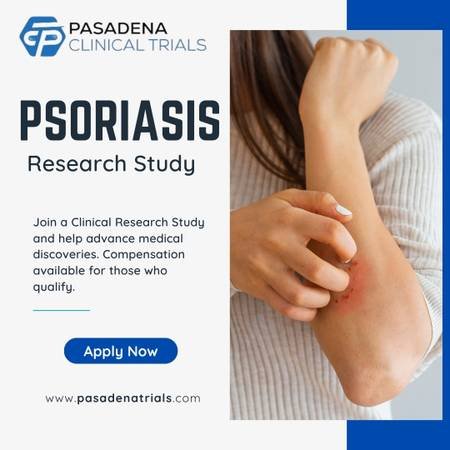 Earn Compensation for Paid Participation in a Psoriasis Clinical Study (Pasadena)s