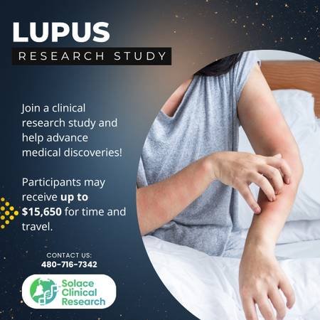Earn up to $15,650 by Joining a Study for Lupus in Tustins