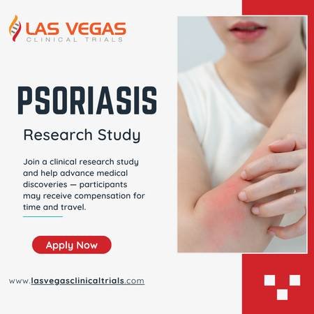 Earn Money for Paid Participation in a Psoriasis Clinical Study in North Las Vegass